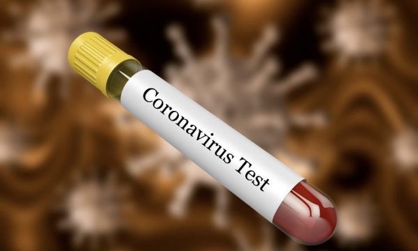  Edhe një rast i ri me koronavirus në Kosovë — shkon në 91 numri i të prekurve