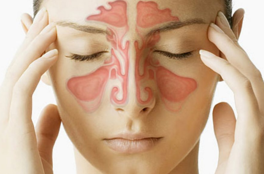  Kundër infeksioneve të sinusit – mënyrat natyrale të trajtimit